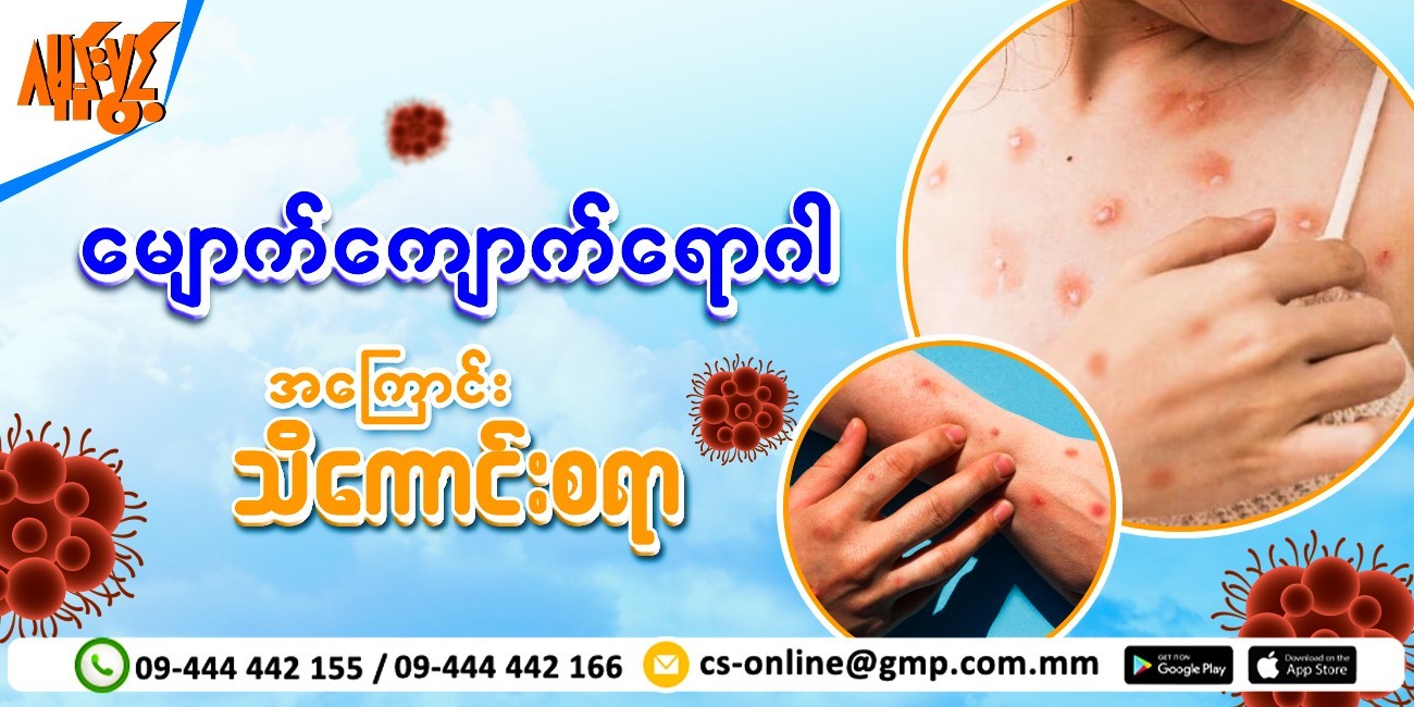 မျောက်ကျောက်ရောဂါအကြောင်း သိကောင်းစရာ